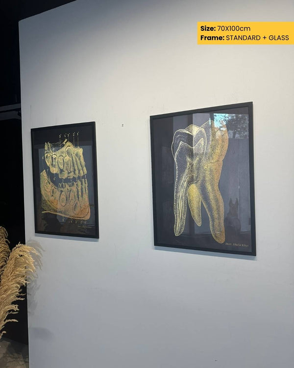 Two framed dental artwork prints on a white wall.